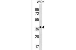 CLCA3P Antibody (Center) (ABIN1538576 and ABIN2850211) western blot analysis in WiDr cell line lysates (35 μg/lane).