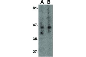Image no. 2 for anti-Tachykinin Receptor 3 (TACR3) (Internal Region) antibody (ABIN6655770)