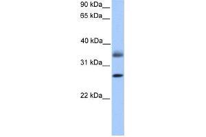 Image no. 1 for anti-Lectin, Galactoside-Binding, Soluble, 8 (LGALS8) (C-Term) antibody (ABIN2785503)