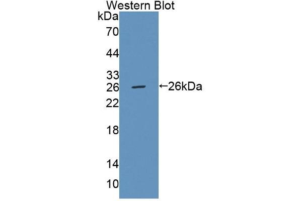 anti-Fas-Activated serine/threonine Kinase (FASTK) (AA 330-524) antibody