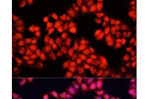 Immunofluorescence analysis of HeLa cells using ALAD Polyclonal Antibody at dilution of 1:100.