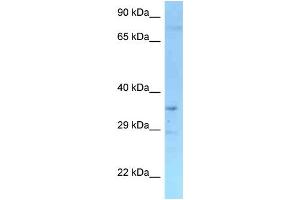 Image no. 1 for anti-Ring Finger and FYVE-Like Domain Containing 1 (RFFL) (N-Term) antibody (ABIN2775665)