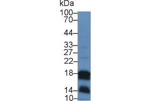 Cathelicidin antibody  (AA 31-172)