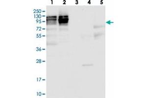 Image no. 1 for anti-Nucleolar Protein 1 (NOL1) antibody (ABIN5584610)