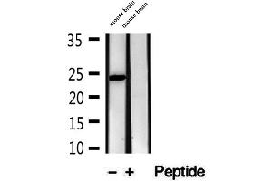 Image no. 1 for anti-MAD2 Mitotic Arrest Deficient-Like 2 (MAD2L2) (Internal Region) antibody (ABIN6263049)