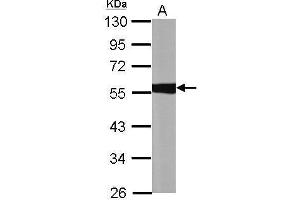 Image no. 5 for anti-Aldehyde Dehydrogenase 1 Family, Member A1 (ALDH1A1) (C-Term) antibody (ABIN2857033)