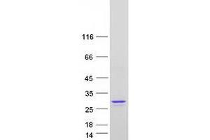 Image no. 1 for ADP Ribosylation Factor Like GTPase 6 (ARL6) (Transcript Variant 1) protein (Myc-DYKDDDDK Tag) (ABIN2714914)