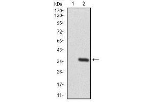 Image no. 5 for anti-Twinfilin, Actin-Binding Protein 1 (TWF1) antibody (ABIN1491429)
