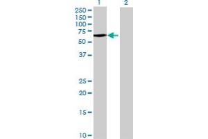 Image no. 1 for anti-Glomulin, FKBP Associated Protein (GLMN) (AA 1-594) antibody (ABIN524569)