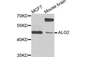 Image no. 1 for anti-Asparagine-Linked Glycosylation 2, alpha-1,3-Mannosyltransferase Homolog (ALG2) antibody (ABIN2736258)