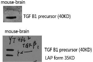 Image no. 1 for anti-Transforming Growth Factor, beta 1 (TGFB1) (C-Term) antibody (ABIN3187249)