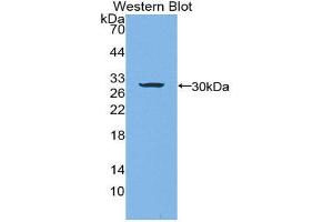 Laminin beta 3 antibody  (AA 503-738)