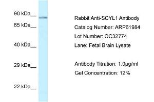 Image no. 1 for anti-SCY1-Like 1 (SCYL1) (C-Term) antibody (ABIN2788975)