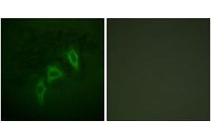 Image no. 3 for anti-Tuberous Sclerosis 2 (TSC2) (AA 905-954) antibody (ABIN1532423)