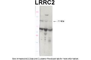 Image no. 2 for anti-Leucine Rich Repeat Containing 2 (LRRC2) (N-Term) antibody (ABIN2775503)