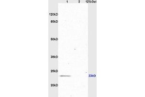 Image no. 4 for anti-Glial Cell Line Derived Neurotrophic Factor (GDNF) (AA 121-211) antibody (ABIN736536)