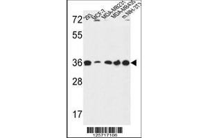 Image no. 1 for anti-Torsin Family 1, Member B (Torsin B) (TOR1B) (AA 210-237) antibody (ABIN650967)