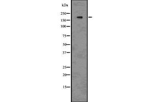 Image no. 2 for anti-SWI/SNF Related, Matrix Associated, Actin Dependent Regulator of Chromatin, Subfamily A, Member 4 (SMARCA4) (N-Term) antibody (ABIN6260313)