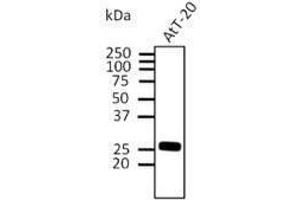 Image no. 2 for anti-RAB3A, Member RAS Oncogene Family (RAB3A) (C-Term) antibody (ABIN1440023)