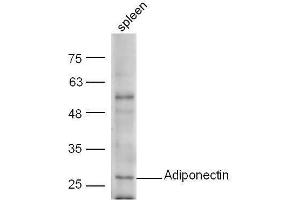 anti-Adiponectin (ADIPOQ) (AA 151-244) antibody