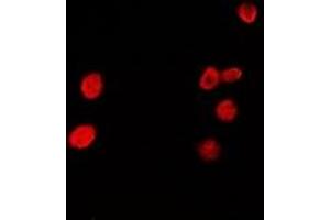 Image no. 1 for anti-Hepatoma-Derived Growth Factor-Related Protein 2 (HDGFRP2) antibody (ABIN2966729)