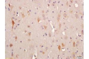 Image no. 4 for anti-Adenylate Cyclase 10 (Soluble) (ADCY10) (AA 1101-1200) antibody (ABIN751093)