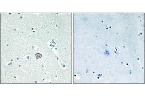Image no. 2 for anti-Adenosine A2a Receptor (ADORA2A) (AA 321-370) antibody (ABIN1535641)