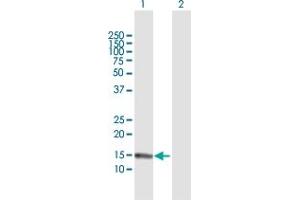 Image no. 2 for anti-S100 Calcium Binding Protein A7 (S100A7) (AA 1-101) antibody (ABIN519955)