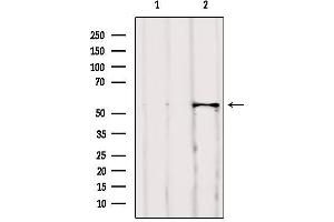Image no. 4 for anti-V-Akt Murine Thymoma Viral Oncogene Homolog 1 (AKT1) antibody (ABIN6259867)