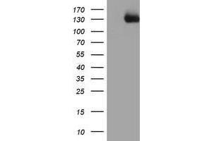 Image no. 3 for anti-PTK7 Protein tyrosine Kinase 7 (PTK7) antibody (ABIN1497127)