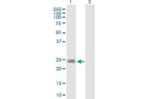 LDHAL6A antibody  (AA 1-234)