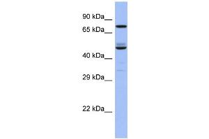 Image no. 1 for anti-TBC1 Domain Family, Member 25 (TBC1D25) (C-Term) antibody (ABIN2786666)