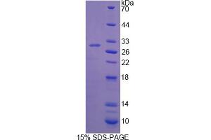 Image no. 1 for Tyrosine Hydroxylase (TH) (AA 82-310) protein (His tag) (ABIN6236747)