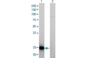 Western Blot analysis of RAB39B expression in transfected 293T cell line by RAB39B monoclonal antibody (M01), clone 1E11.
