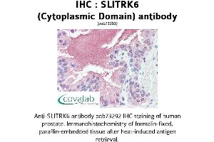 Image no. 2 for anti-SLIT and NTRK-Like Family, Member 6 (SLITRK6) (Cytoplasmic Domain) antibody (ABIN1739440)