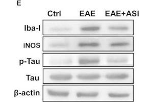 Western Blotting (WB) image for anti-Allograft Inflammatory Factor 1 (AIF1) (C-Term) antibody (ABIN2857032)