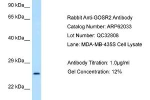 Image no. 1 for anti-Golgi SNAP Receptor Complex Member 2 (GOSR2) (N-Term) antibody (ABIN2788997)