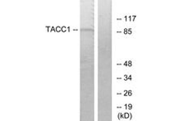 anti-Transforming, Acidic Coiled-Coil Containing Protein 1 (TACC1) (AA 11-60) antibody