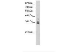 anti-Zinc Finger Protein 197 (ZNF197) (N-Term) antibody