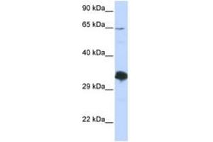 Image no. 1 for anti-Zinc Finger Protein 630 (ZNF630) (C-Term) antibody (ABIN6742948)