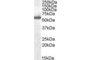 Image no. 3 for anti-Interferon Regulatory Factor 5 (IRF5) (C-Term) antibody (ABIN184812)