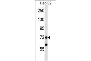 Image no. 1 for anti-TAF6 RNA Polymerase II, TATA Box Binding Protein (TBP)-Associated Factor, 80kDa (TAF6) (AA 24-53), (N-Term) antibody (ABIN5537603)