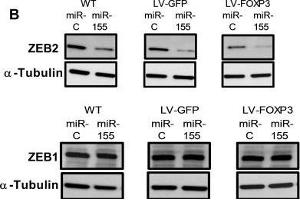 miR-155 and FOXP3 down regulate endogenous ZEB2 in human breast cancer cells resulting in altered levels of EMT markers Vimentin and E-cadherin(A) Relative abundance of ZEB2 and ZEB1 protein in WT, GFP or FOXP3 overexpressing BT549 cells transfected with miR-155 or miR-control.