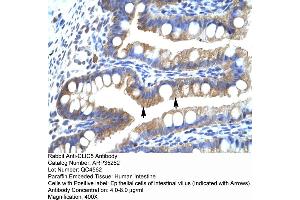 CLIC5 antibody  (Middle Region)