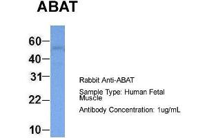 Image no. 1 for anti-4-Aminobutyrate Aminotransferase (ABAT) (Middle Region) antibody (ABIN1105153)