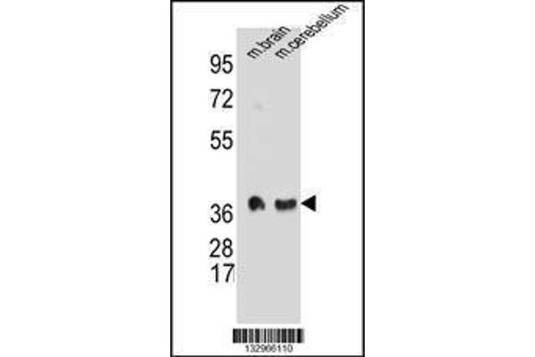 anti-Synaptophysin (SYP) (AA 225-253), (C-Term) antibody