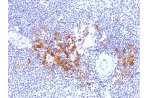 Image no. 1 for anti-TNF Receptor-Associated Factor 1 (TRAF1) (AA 73-219) antibody (ABIN6940805)
