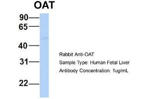 Image no. 2 for anti-Ornithine Aminotransferase (OAT) (Middle Region) antibody (ABIN2783233)