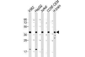 PPID Antikörper  (AA 336-370)