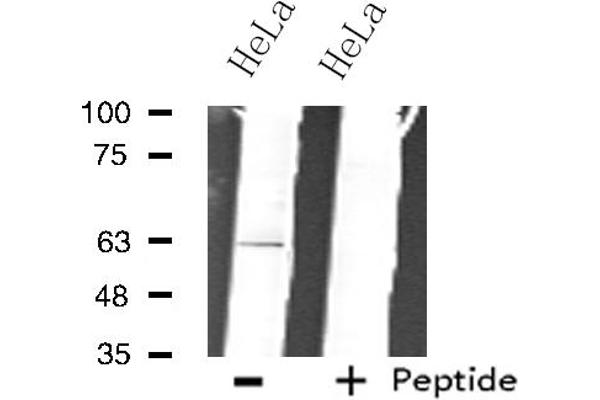 anti-Zinc Finger Protein 18 (ZNF18) (C-Term) antibody